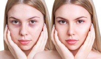 goz-alti-morluklari-nasil-gecer