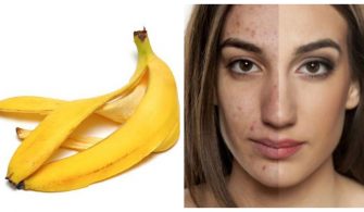 muz-kabugunun-faydalari-ve-yararlari