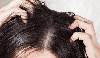 yagli-saclar-icin-sampuan-onerileri