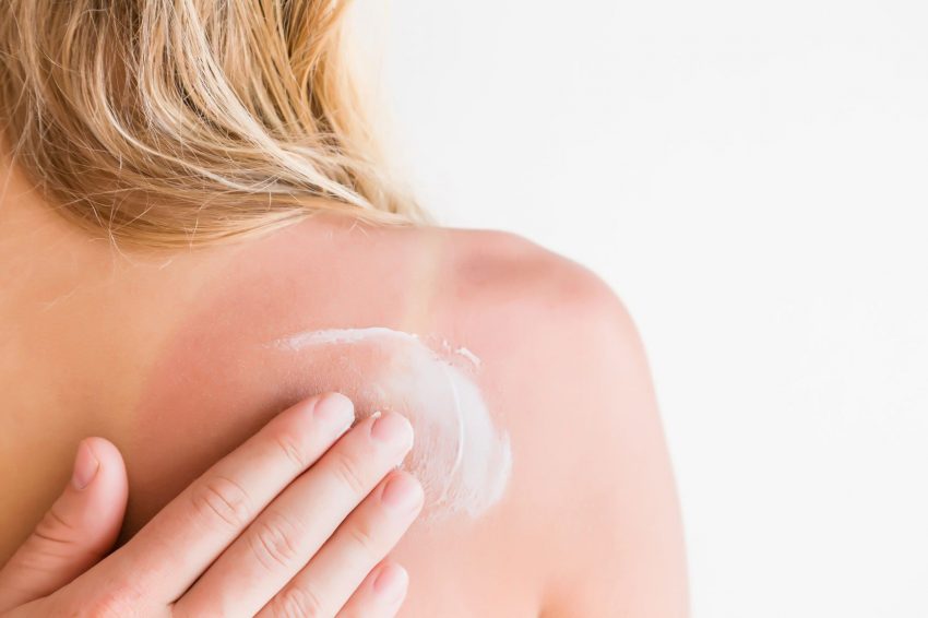 gunes-yanigina-iyi-gelenler-1