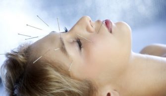 akupunktur-zayiflama