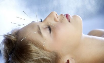 akupunktur-zayiflama