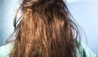 kuru-saclar-icin-oneriler-herseykadincom